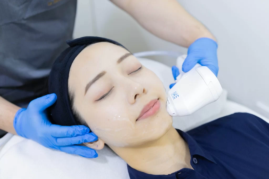 treating melasma with pico hybrid laser