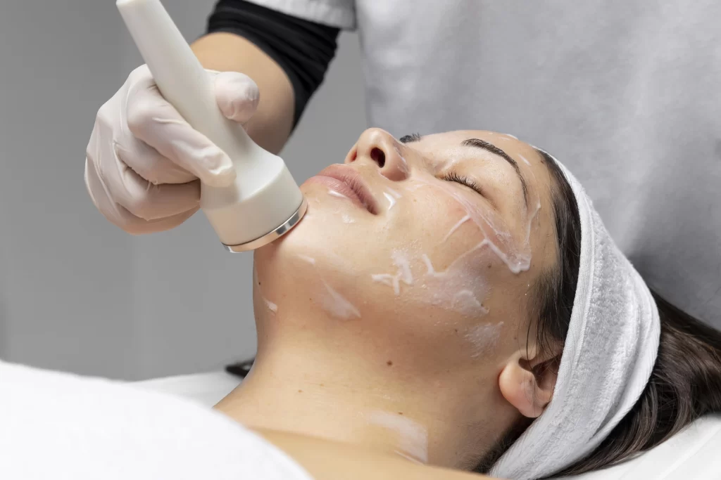 acne toning laser